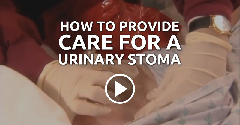 how-to-provide-care-for-a-urinary-stoma-qd-nurses