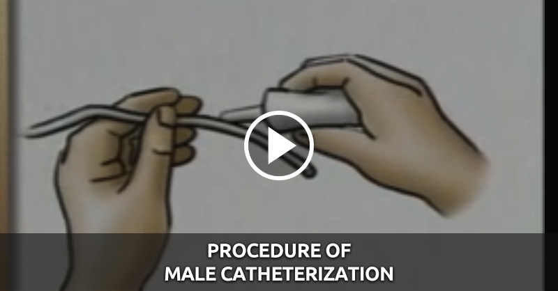 Procedure Of Male Catheterization QD Nurses   Male Catherization2 