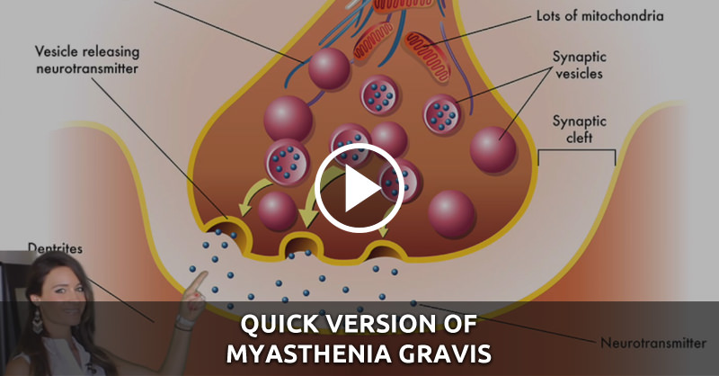 Quick Version of Myasthenia Gravis - QD Nurses