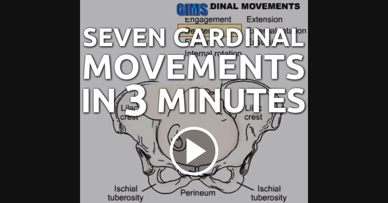 7 cardinal movements of labor quizlet