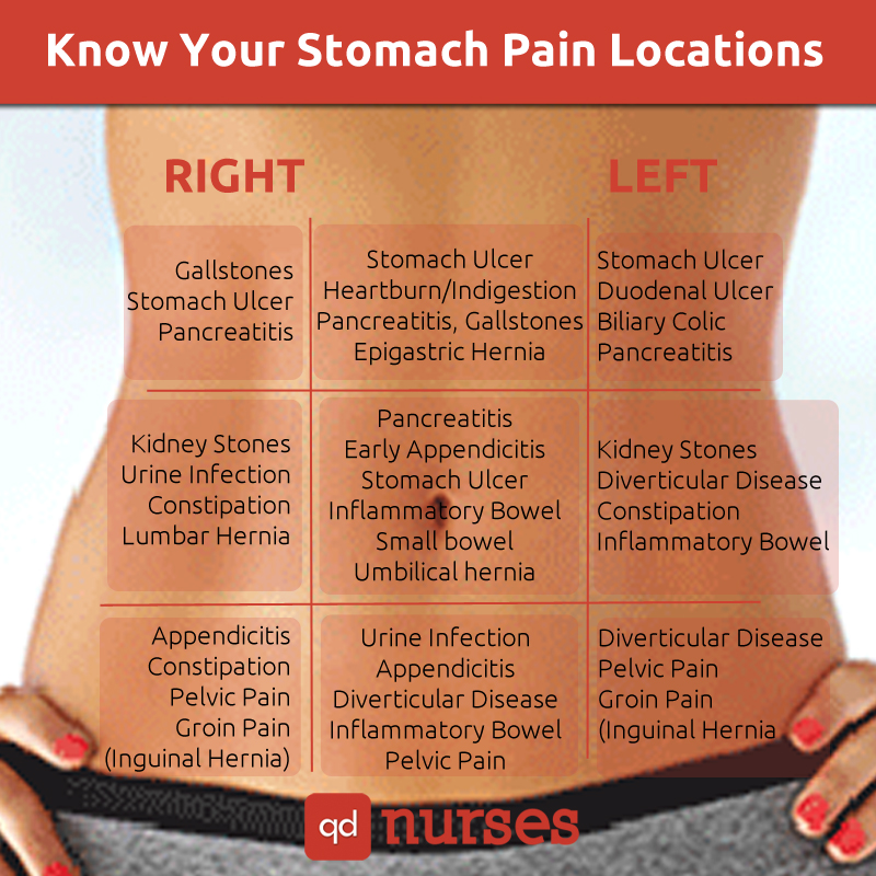 Stomach Pain Locations Chart For The NCLEX QD Nurses