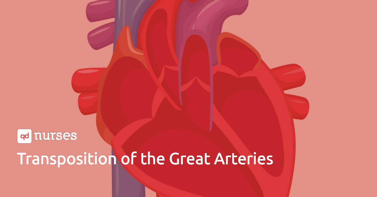 transposition-of-the-great-arteries-qd-nurses